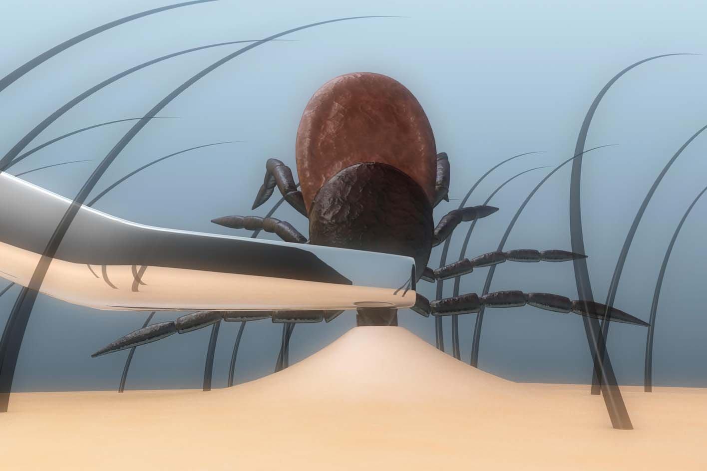 an illustration of tick removal